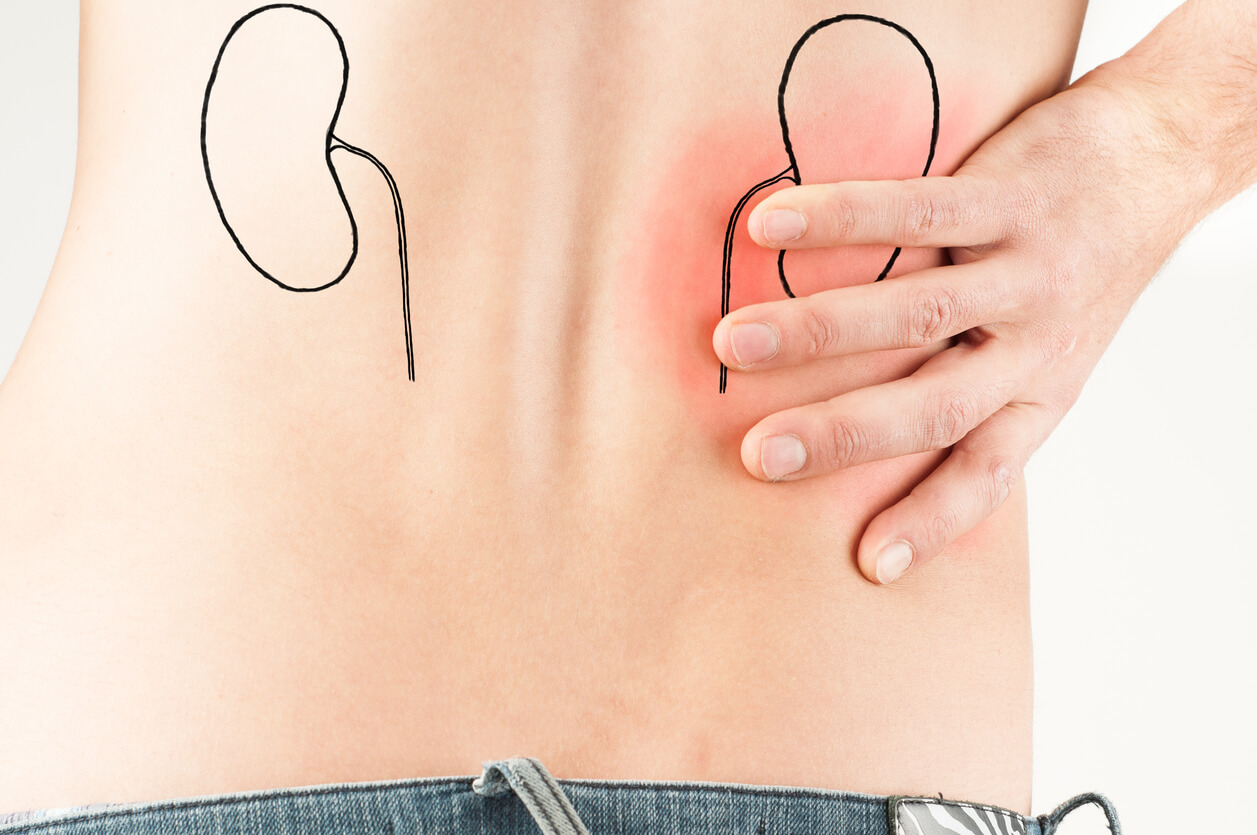 طب سوزنی راه درمان سنگ کلیه از نظر طب سنتی سنگ کلیه طب سوزنی راه درمان سنگ کلیه از نظر طب سنتی سنگ کلیه